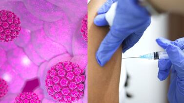 Una sola dosis de vacuna contra papiloma mantiene protección 16 años después