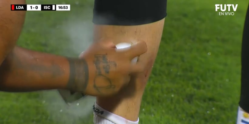 Washington Ortega se lesionó en el partido entre Alajuelense e Inter San Carlos.