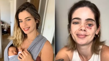 Mujer que fue diagnosticada con cáncer de cabeza y cuello cuenta el primer síntoma que la alarmó: ‘Miedo y dolor’