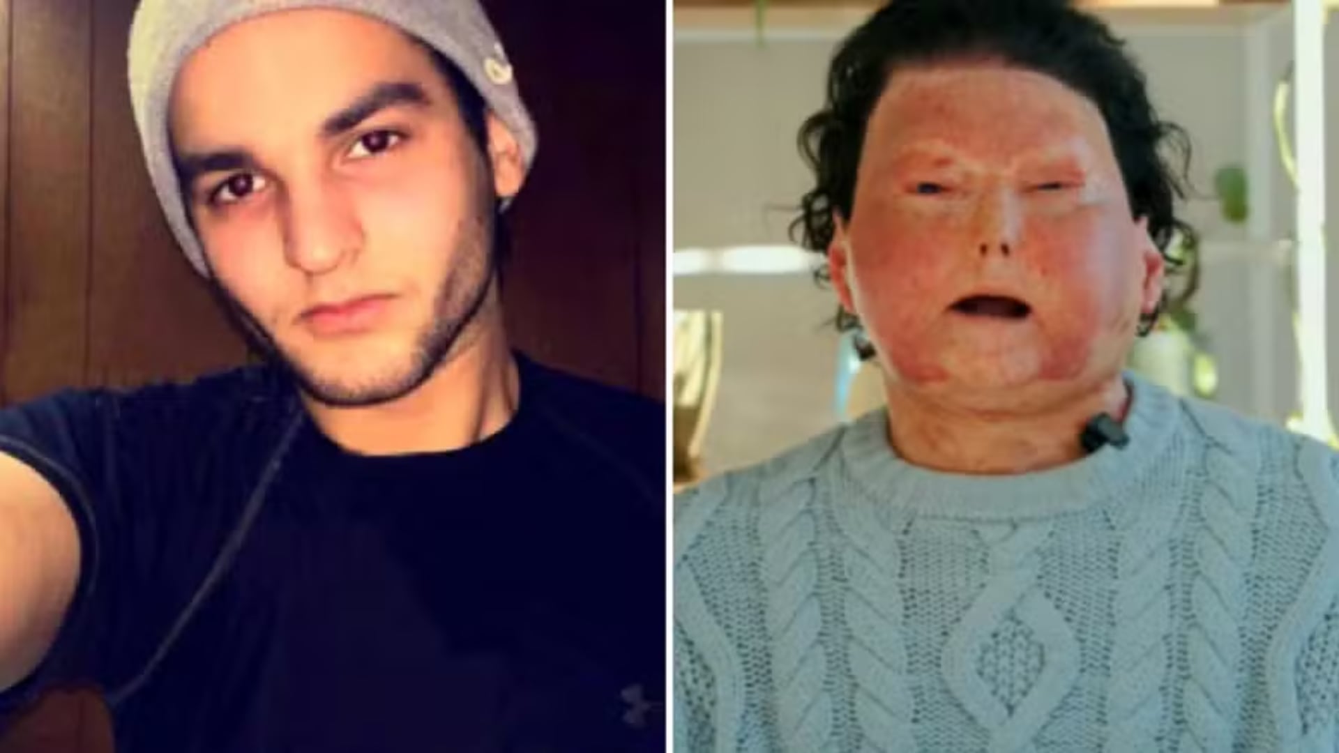 El estadounidense Joe DiMeo recuerda el accidente que lo dejó con quemaduras graves y destaca la importancia de su entrenamiento previo para sobrevivir.