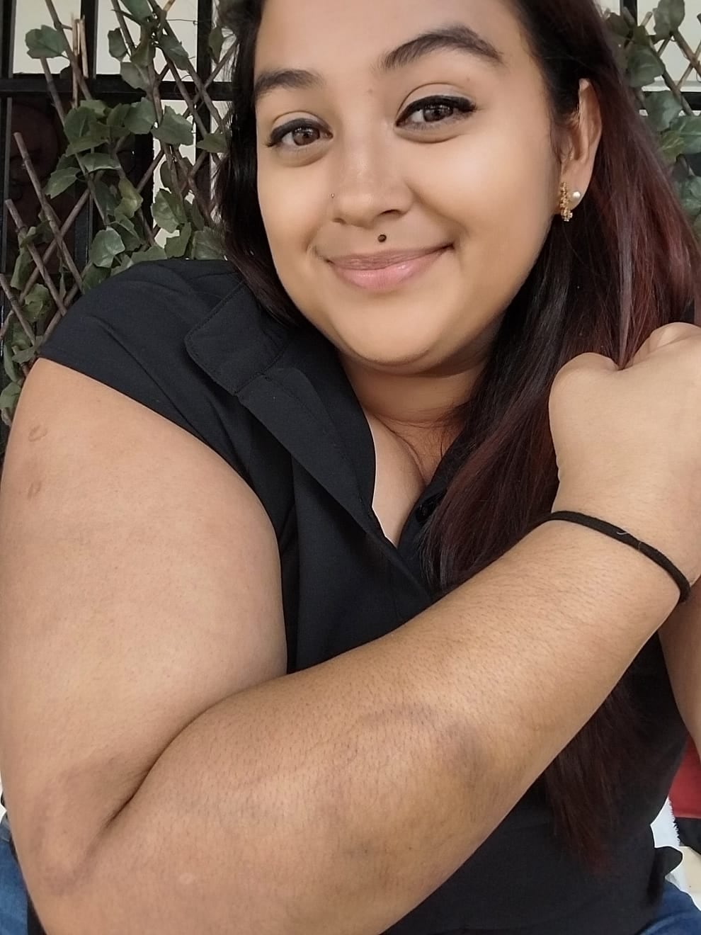 Debido al mordisco que le dio un estudiante, la docente Jimena Gómez Sosa fue incapacitada en junio del 2024.