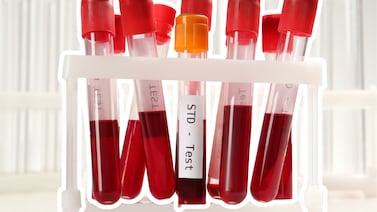 Infecciones de transmisión sexual (ITS): síntomas, riesgos y cómo prevenirlas