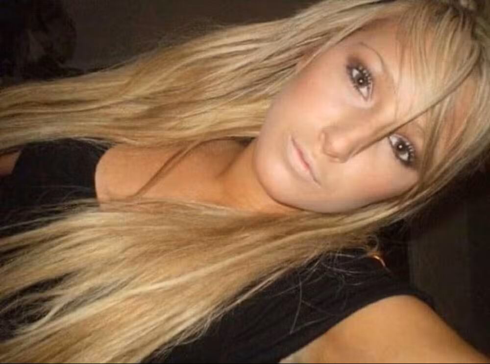 Una foto antigua de cómo lucía antes de la cirugía impresionó a muchos.