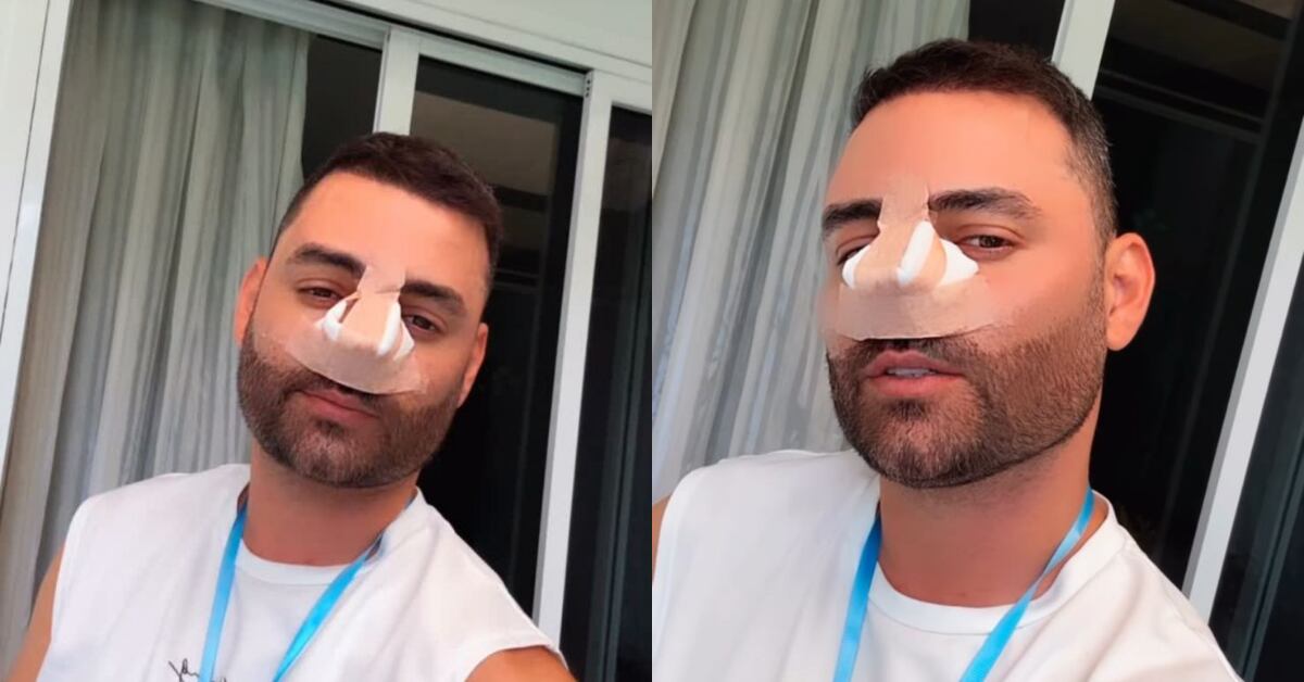 Diego Bravo compartió tres historias con sus seguidores en las que se aprecia el vendaje post operatorio.