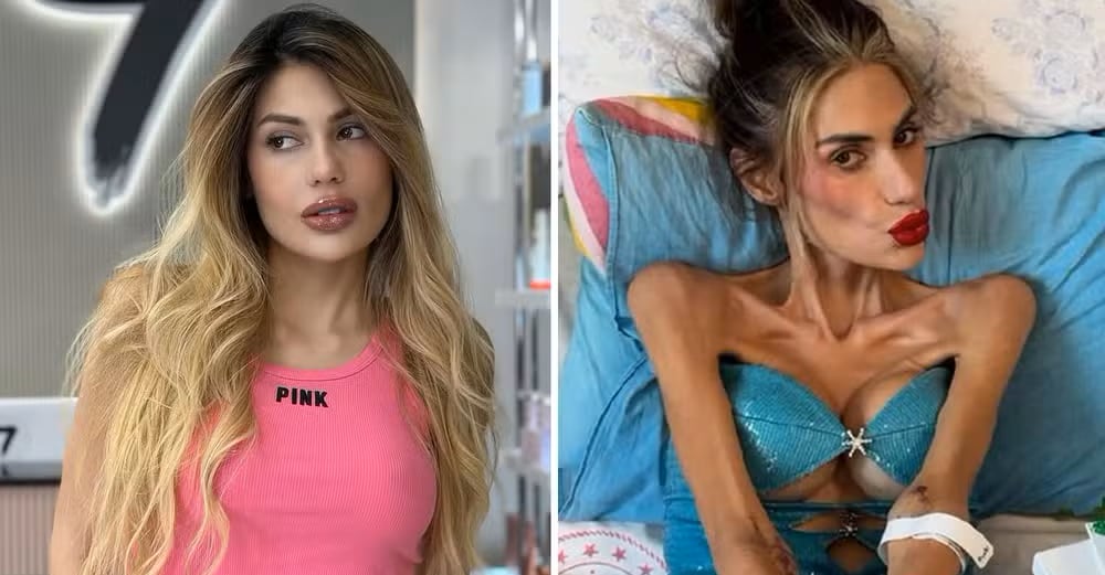 Nihal Candan falleció por complicaciones derivadas de la anorexia, luego de un drástico descenso de peso y una internación crítica.