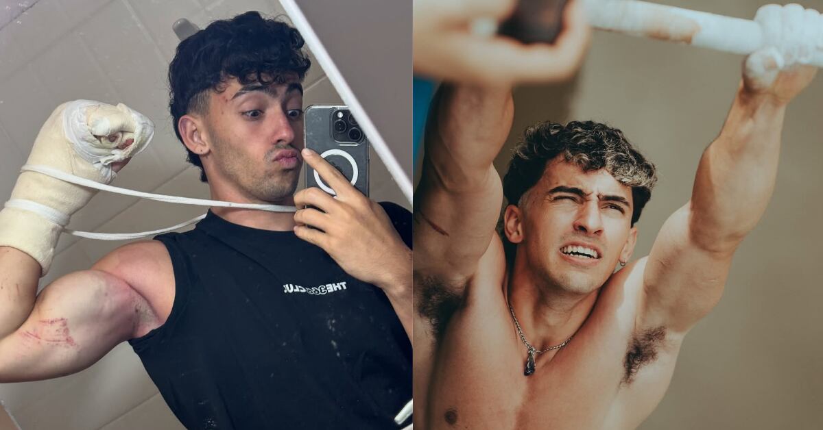 El influencer argentino Gero Arias sufrió un accidente en un cerro. Se le amputaron partes de dos dedos y deberá pausar su actividad deportiva.
