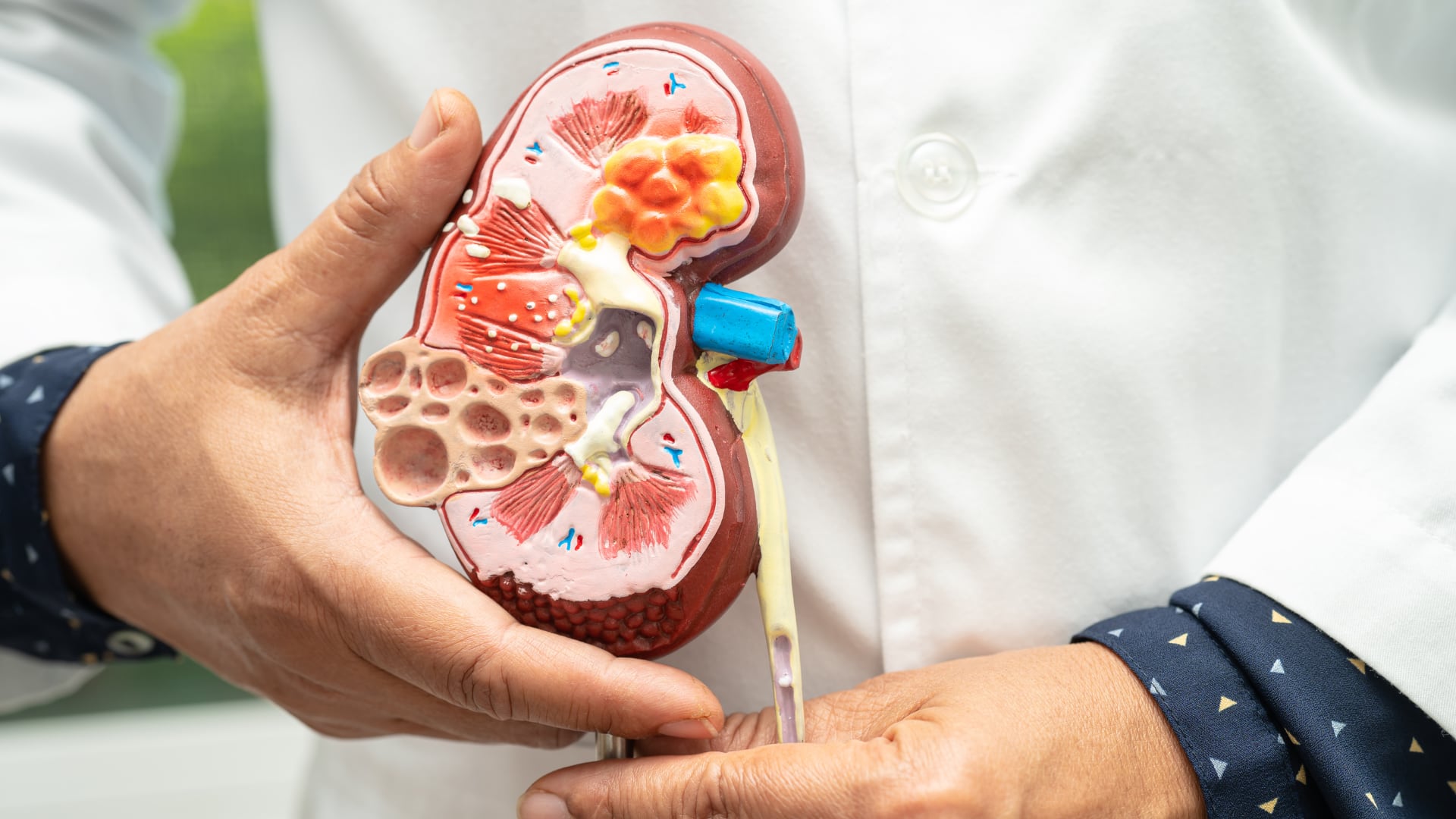 La hidratación con agua simple es la medida más efectiva para mantener la salud renal y prevenir la formación de piedras.