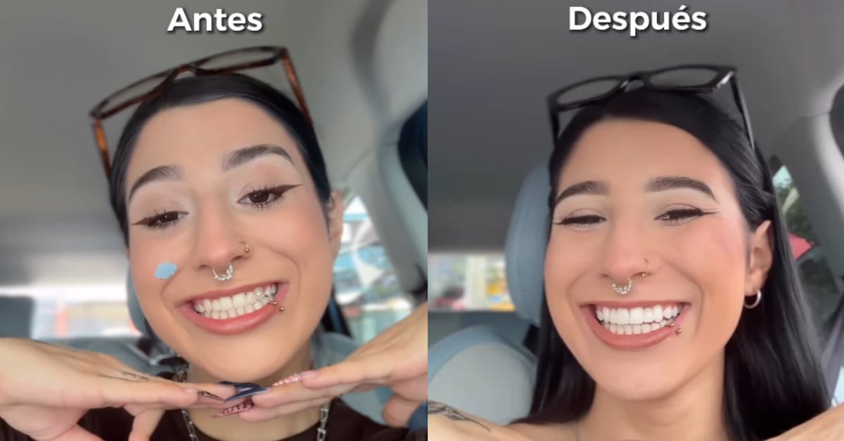 Celeste Rodríguez mostró el antes y después de su sonrisa.