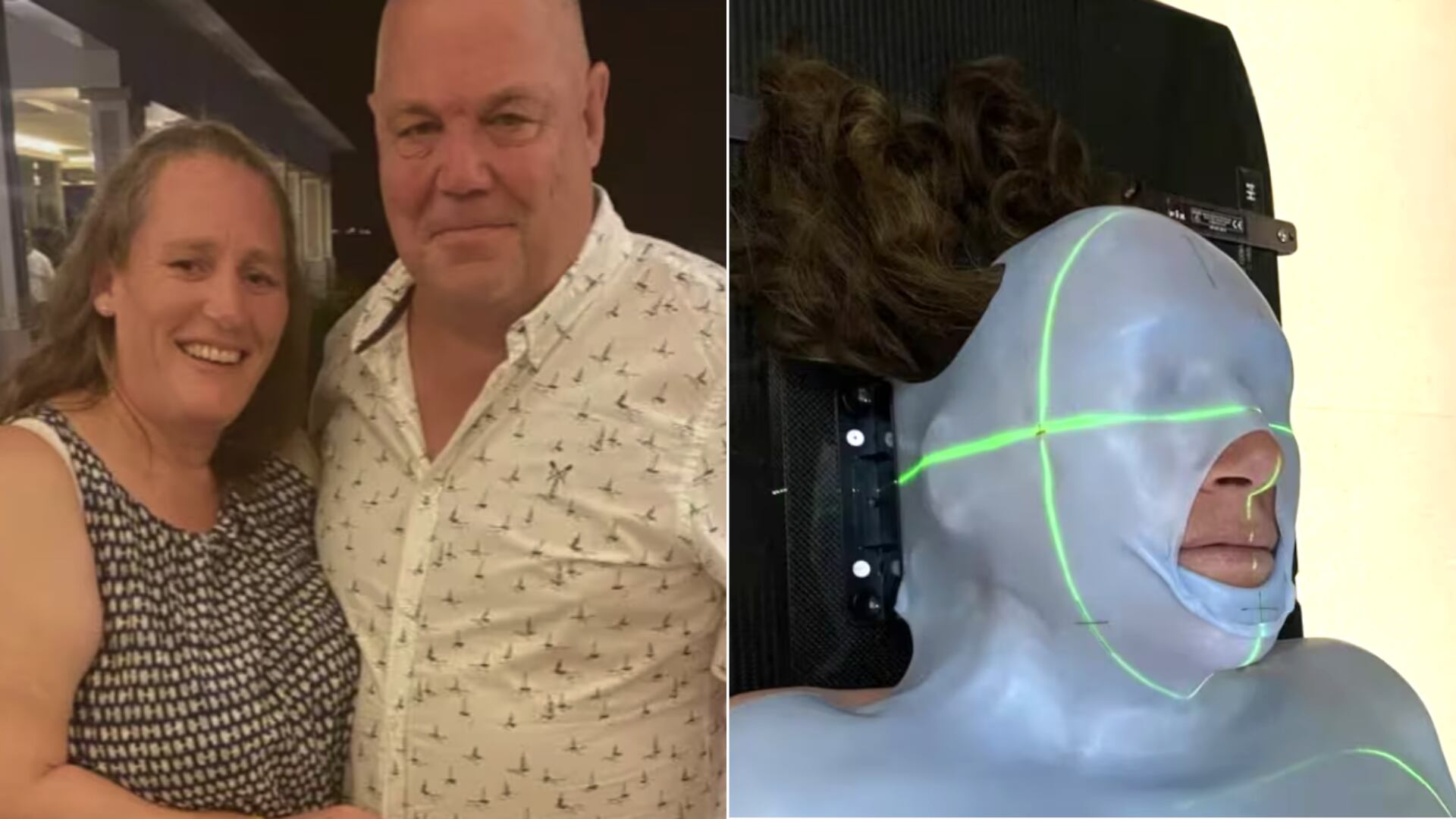 Los ronquidos de Claire escondían un cáncer nasal poco frecuente que requirió cirugía urgente en Inglaterra.