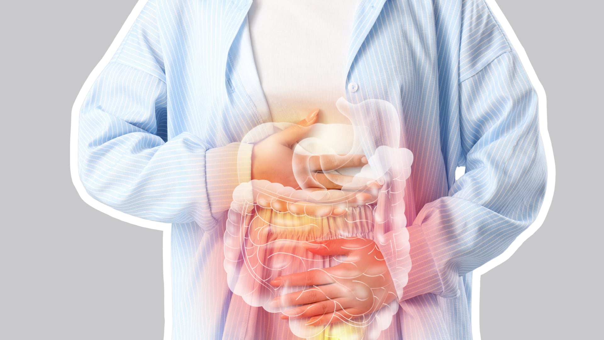 Enfermedad Inflamatoria Intestinal