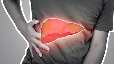 Stephanie Marín, nutricionista: ‘No tener sobrepeso no significa estar libre de hígado graso’