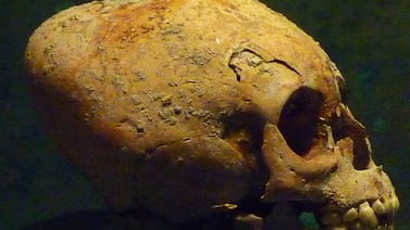 Cráneo con forma cuadrada hallado en México revela antigua técnica de deformación intencional