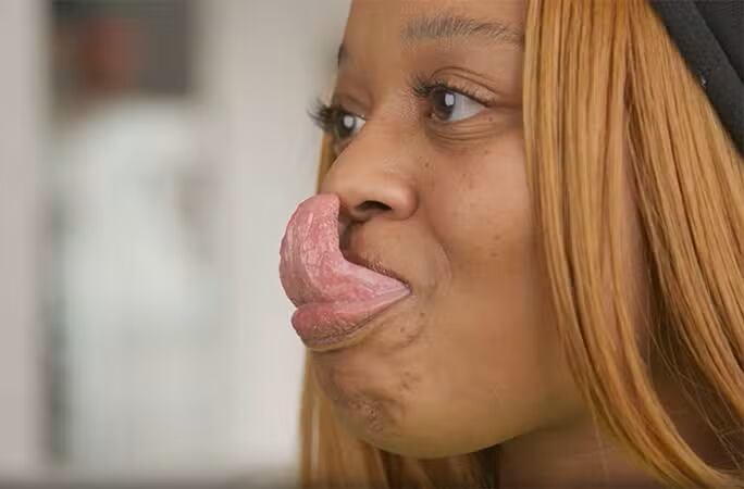 La estadounidense Chanel Tapper, reconocida desde 2010 por el Récord Guinness por tener la lengua femenina más larga del mundo, participó en una campaña publicitaria de la marca Diesel durante 2024. En la sesión fotográfica, su lengua fue pintada de azul y verde como parte de la estética del proyecto.