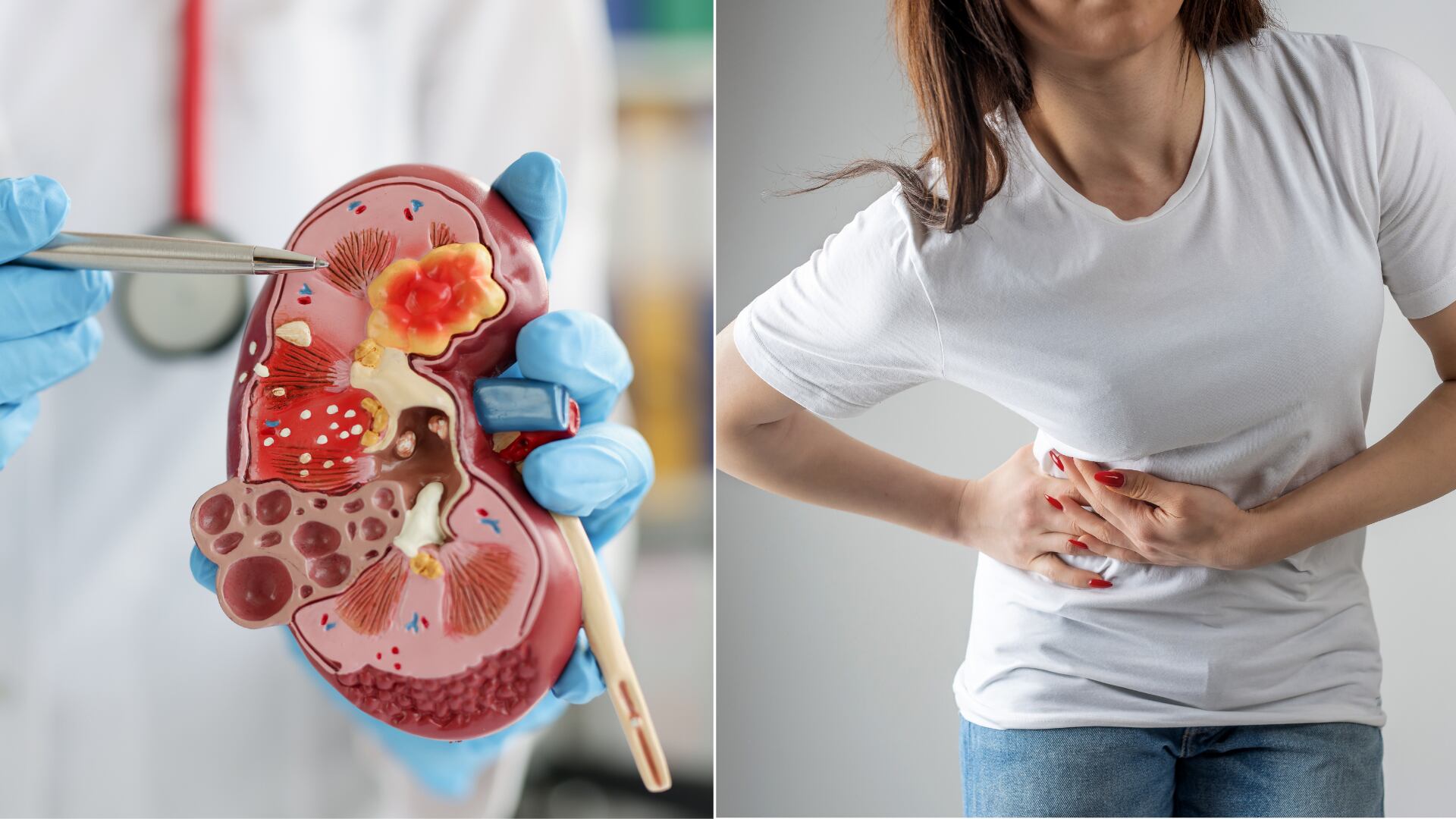 Enfermedades como la diabetes, la hipertensión, la obesidad y los problemas cardíacos afectan directamente la salud de los riñones. La imagen ilustra los riñones y destaca los principales factores de riesgo que comprometen su función, así como la importancia de una detección temprana.