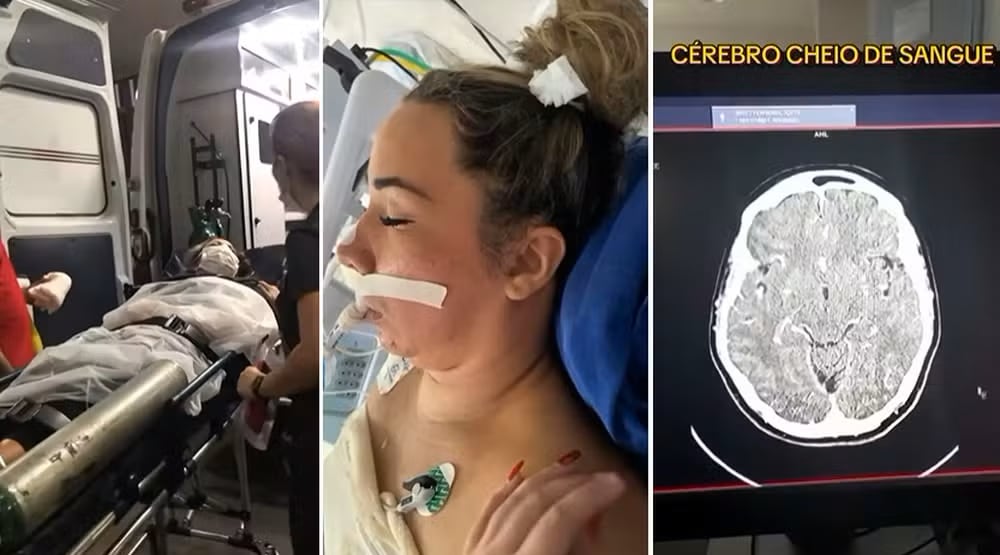 Madre de 40 años entró en coma por ACV y fue desahuciada. Logró recuperarse tras una crisis que la dejó al borde de la muerte.