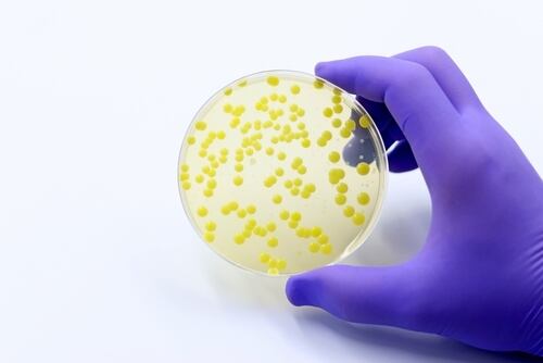 Cultivo de bacterias en una placa de Petri en un laboratorio de microbiología, simbolizando la historia y el avance de la microbiología en la salud pública.