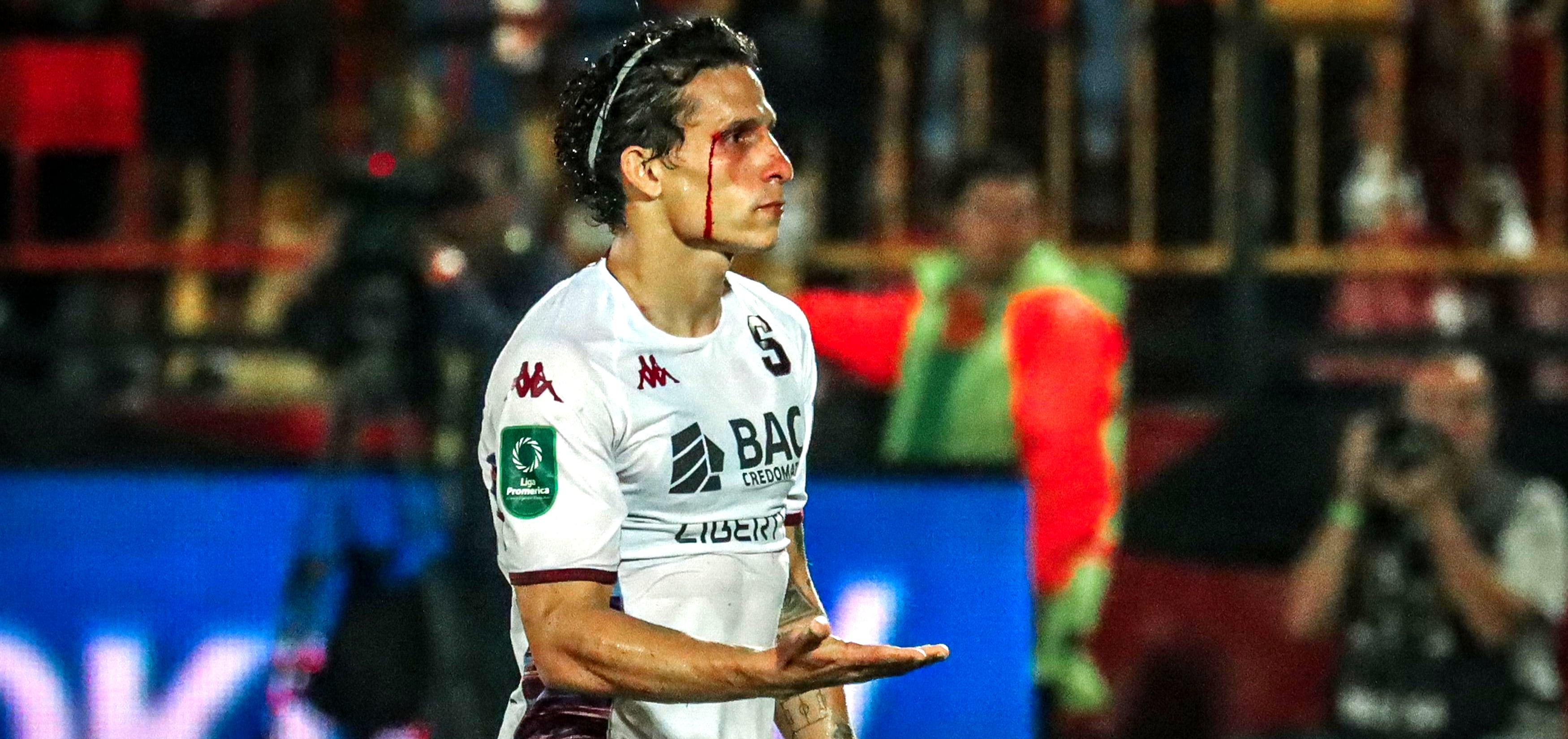 Luis Javier Paradela juego contra Alajuelense