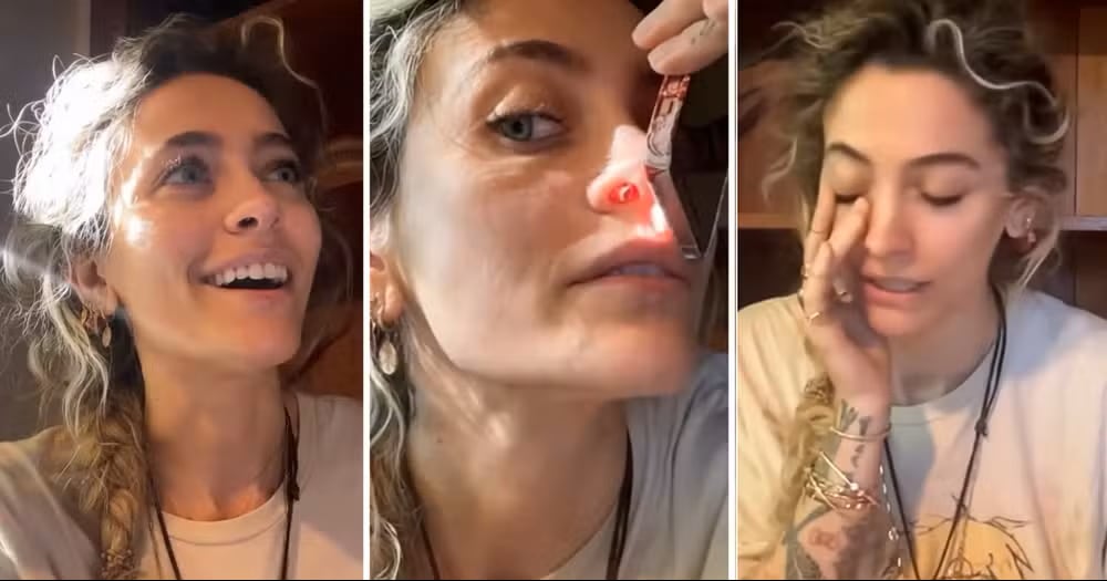Paris Jackson mostró una perforación en su nariz causada por drogas. Contó su historia y dijo que no planea cirugía.