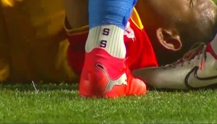Esta es la imagen que se vio de las medias de Dany Carvajal en el partido entre Herediano y Sporting.