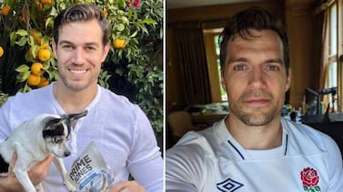 Este es el veterinario que es idéntico a Henry Cavill y genera sensación en redes sociales