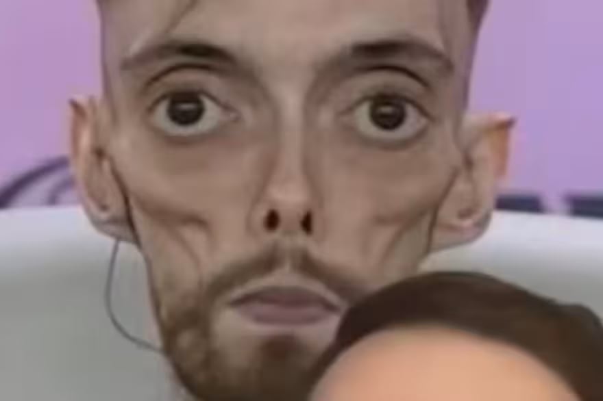 Ibai Llanos bajó más de 50 kilos y pidió detener las burlas sobre su nuevo aspecto físico que circulan en redes.