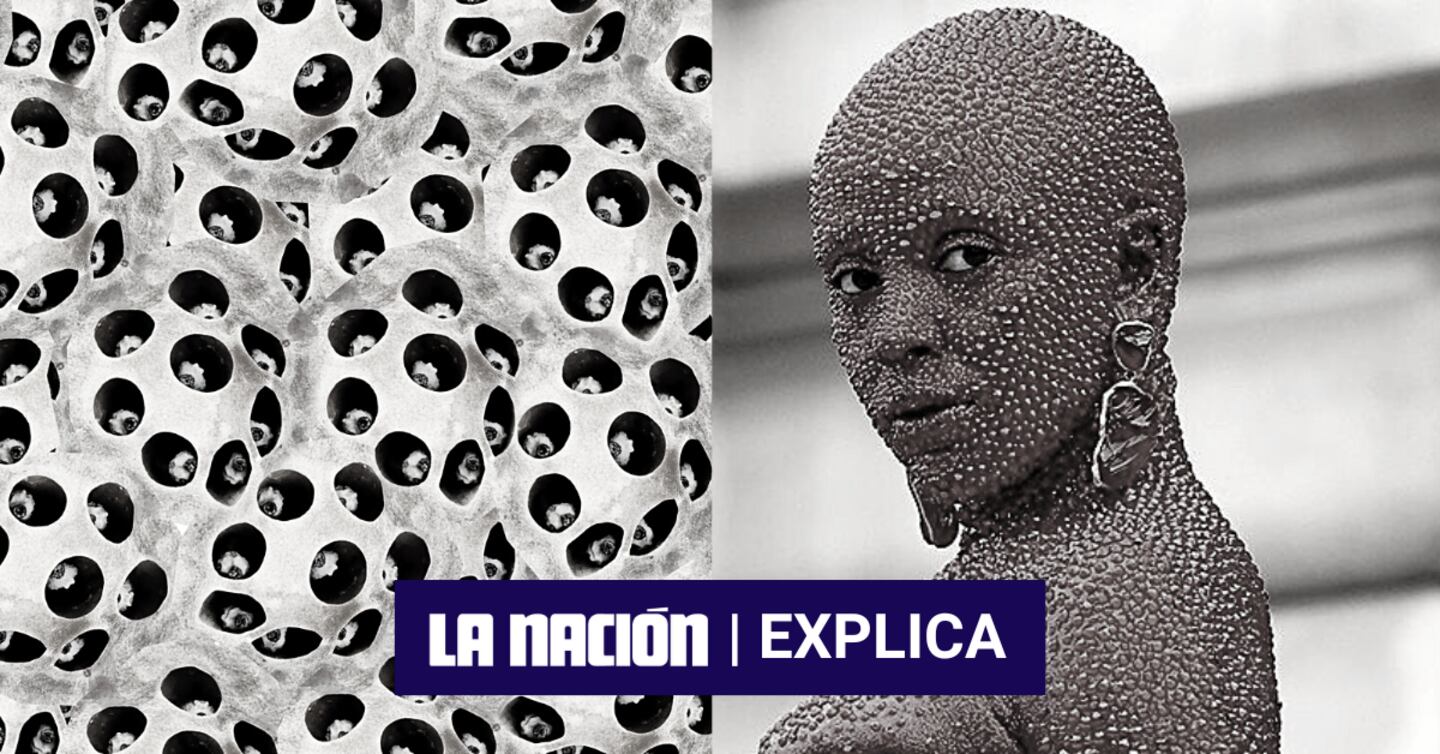 ¿Qué es la tripofobia y por qué se da? | La Nación