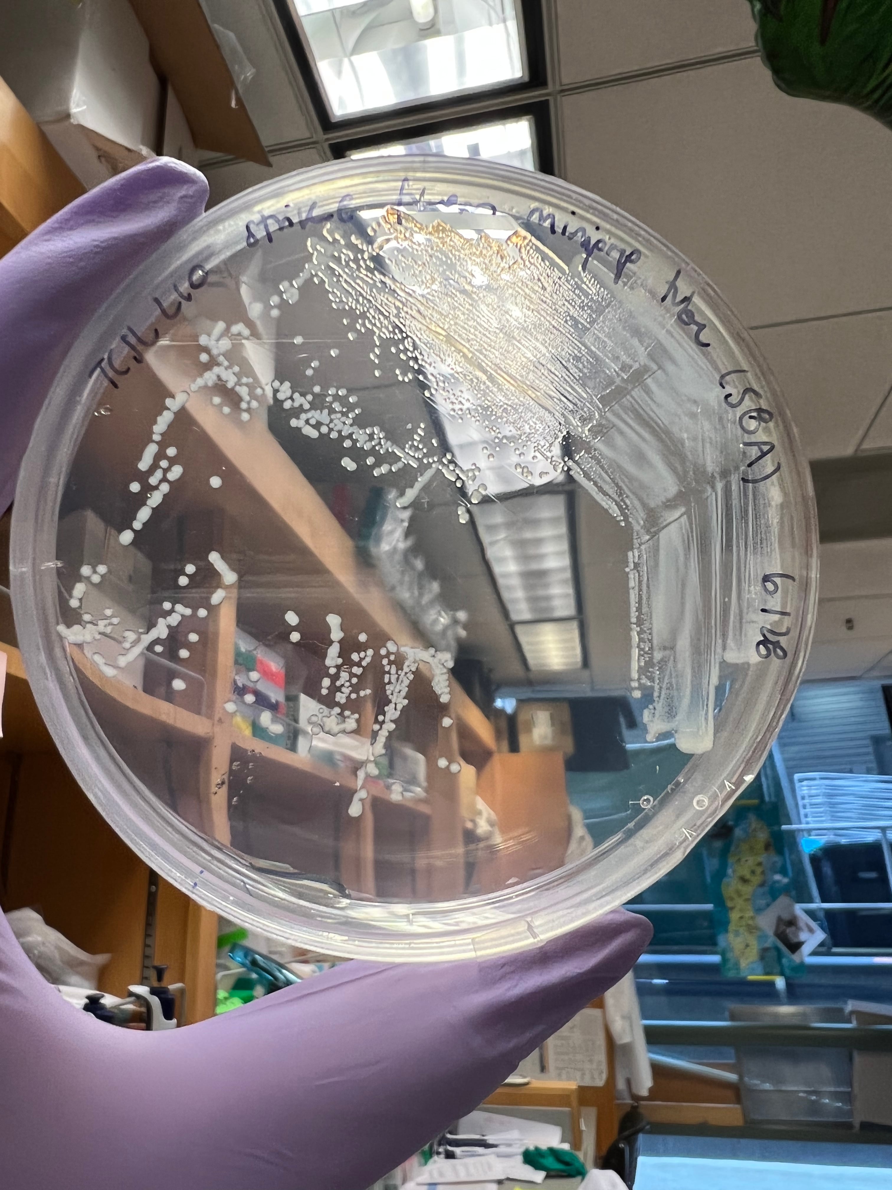 En el MIT, María José Durán trabaja en reprogramación celular, reescribiendo el código de ADN de las células. En la imagen, detalle del trabajo en el laboratorio