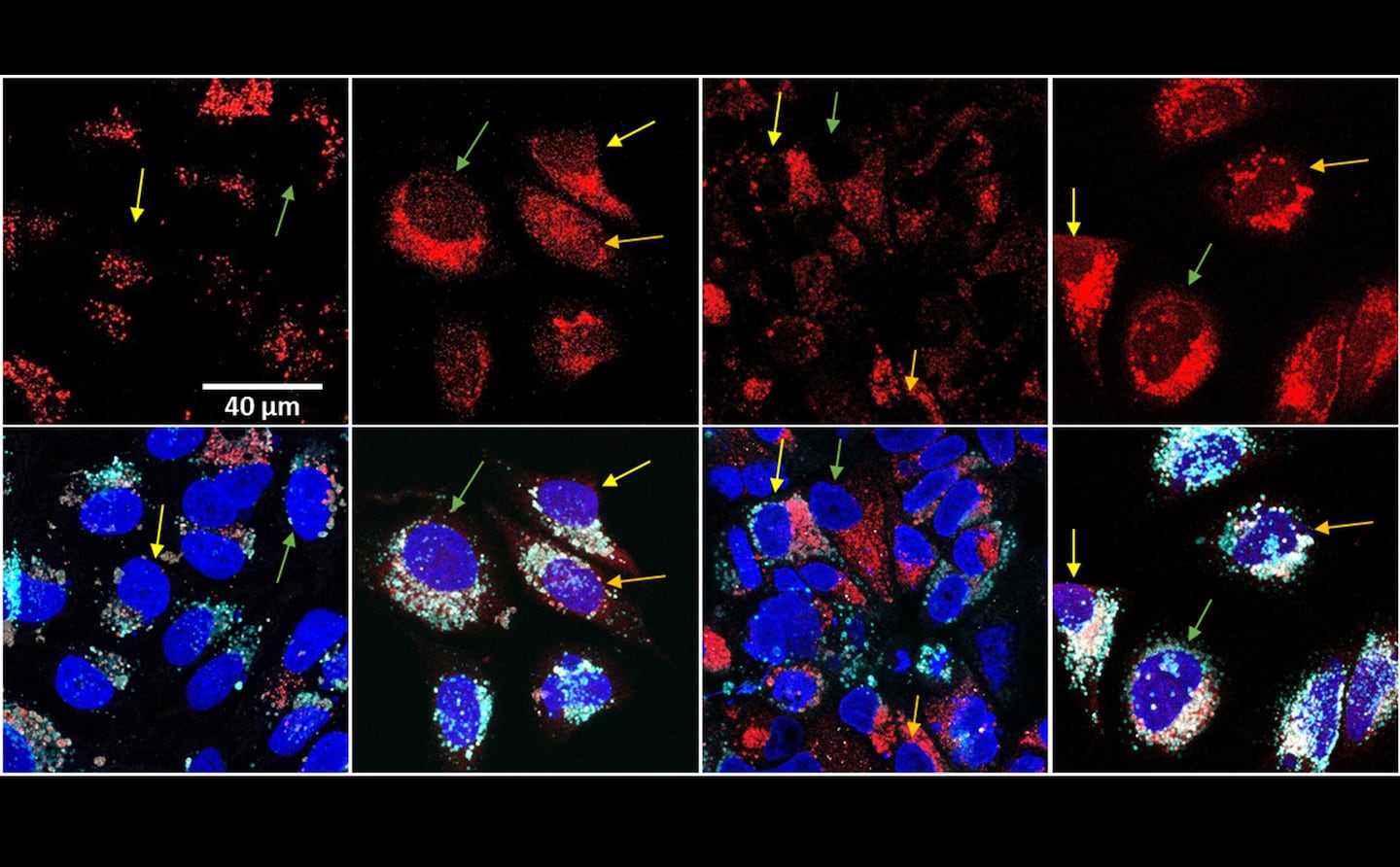 Científicos logran eliminar el 70% de células cancerosas in vitro mediante una potente combinación trimodal