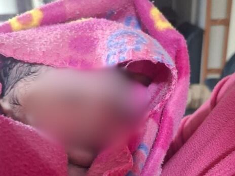 La menor fue puesta en una cobija para poder darle calor.