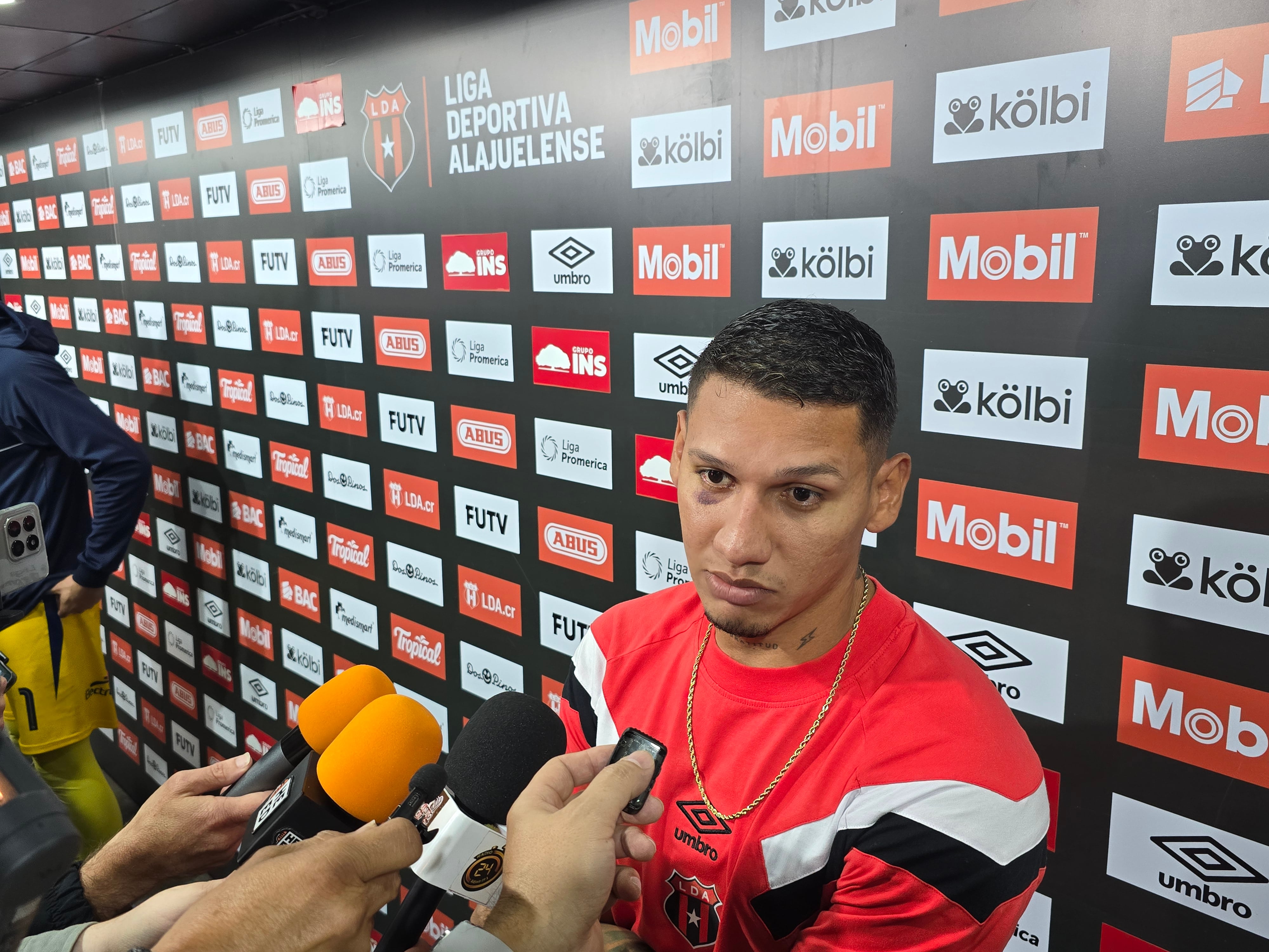 Fernando Piñar será sometido a nuevos exámenes médicos después de que Liga Deportiva Alajuelense regrese de Estados Unidos, para ver cómo se encuentra el hueso de su rostro.