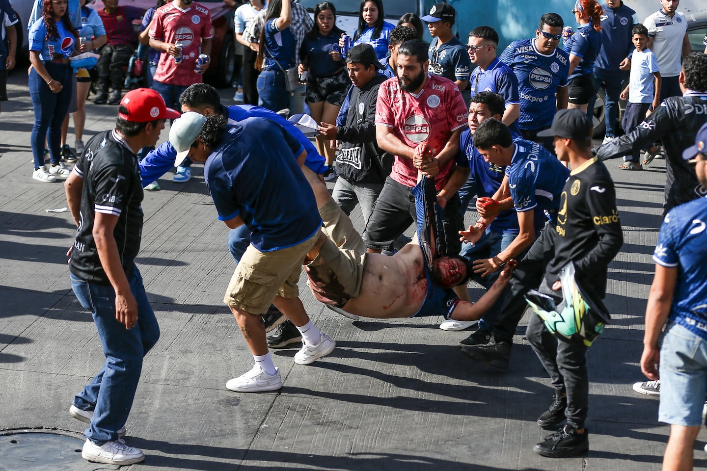 Violencia y cuatro heridos mancharon un clásico en Centroamérica (y aún así se jugó)