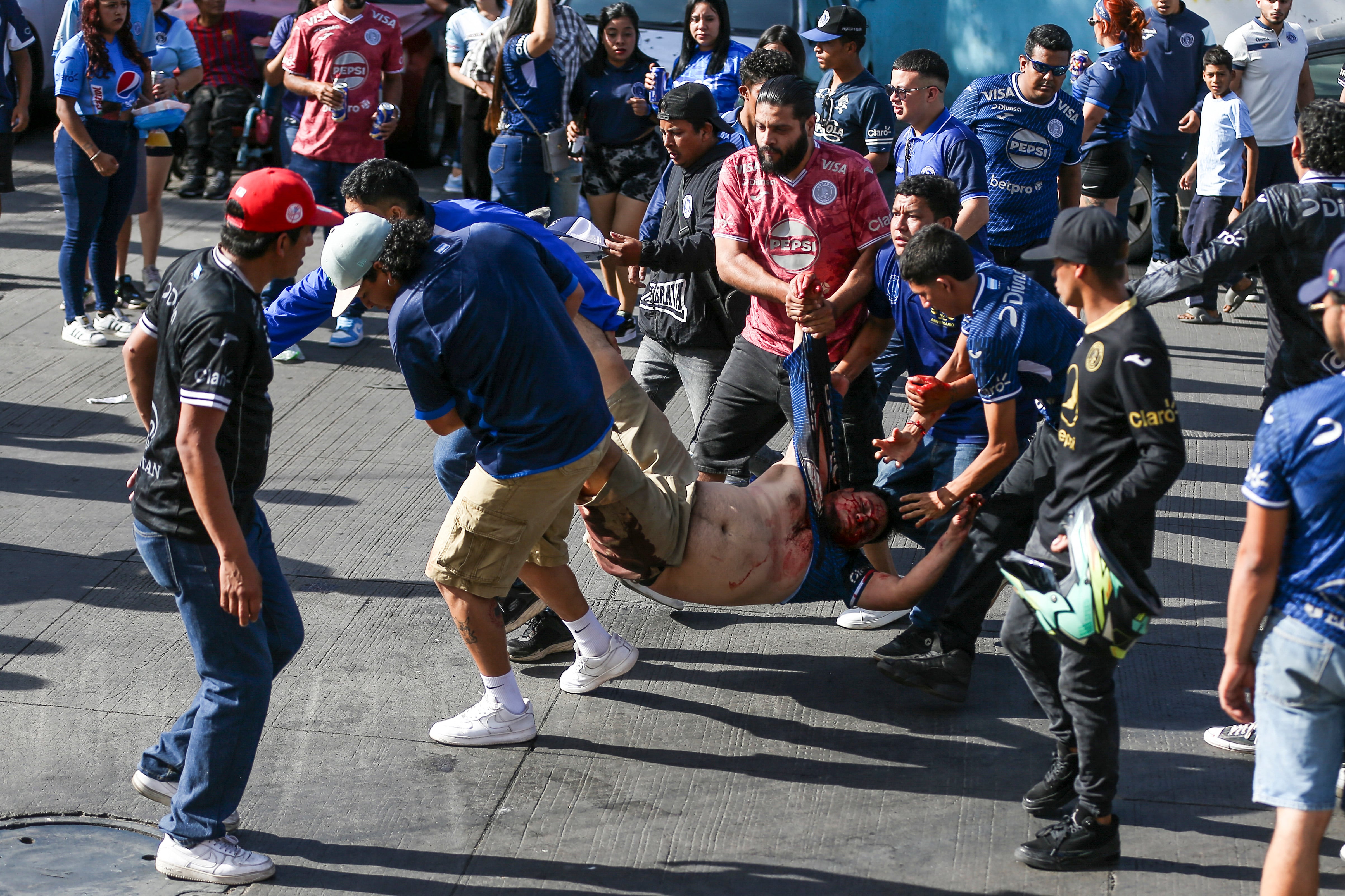 Uno de los heridos es transportado durante la trifulca en Honduras antes del clásico entre Olimpia y Motagua.