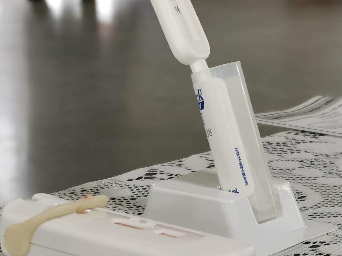 Una autoprueba de VIH en una mesa.