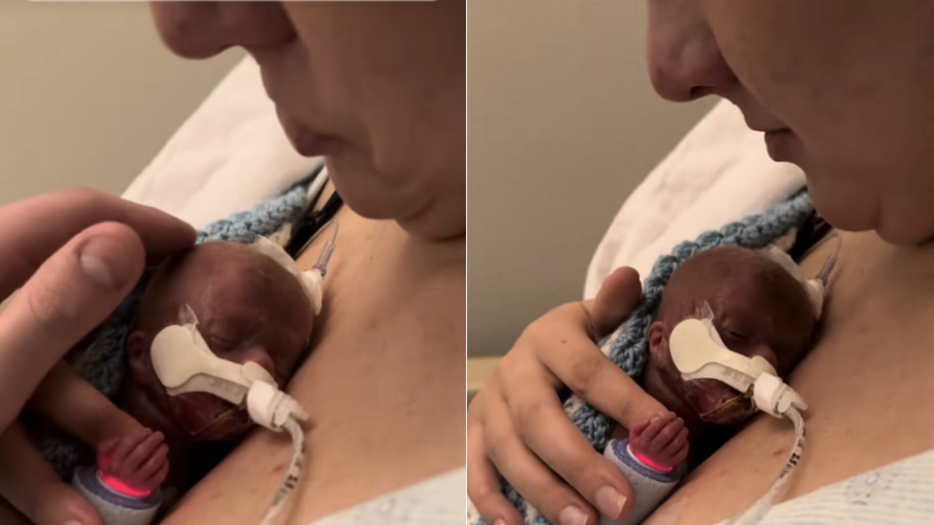 Sydney creyó que sostenía a su hijo por última vez, pero Cooper desafió todas las estadísticas y sigue avanzando a sus 15 meses.