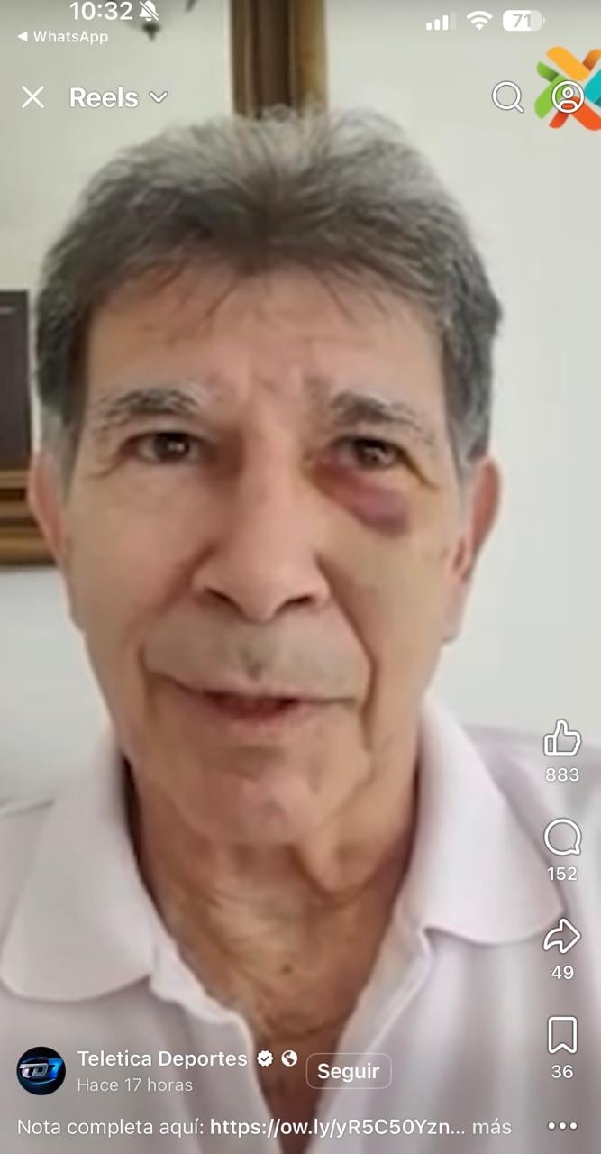 Así quedó Evaristo Coronado luego del choque, esto fue en una entrevista con Teletica.