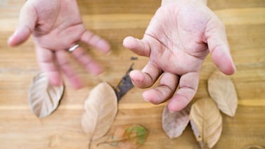 De la boca al cerebro: un estudio relaciona las bacterias asociadas a la caries con el desarrollo del Parkinson
