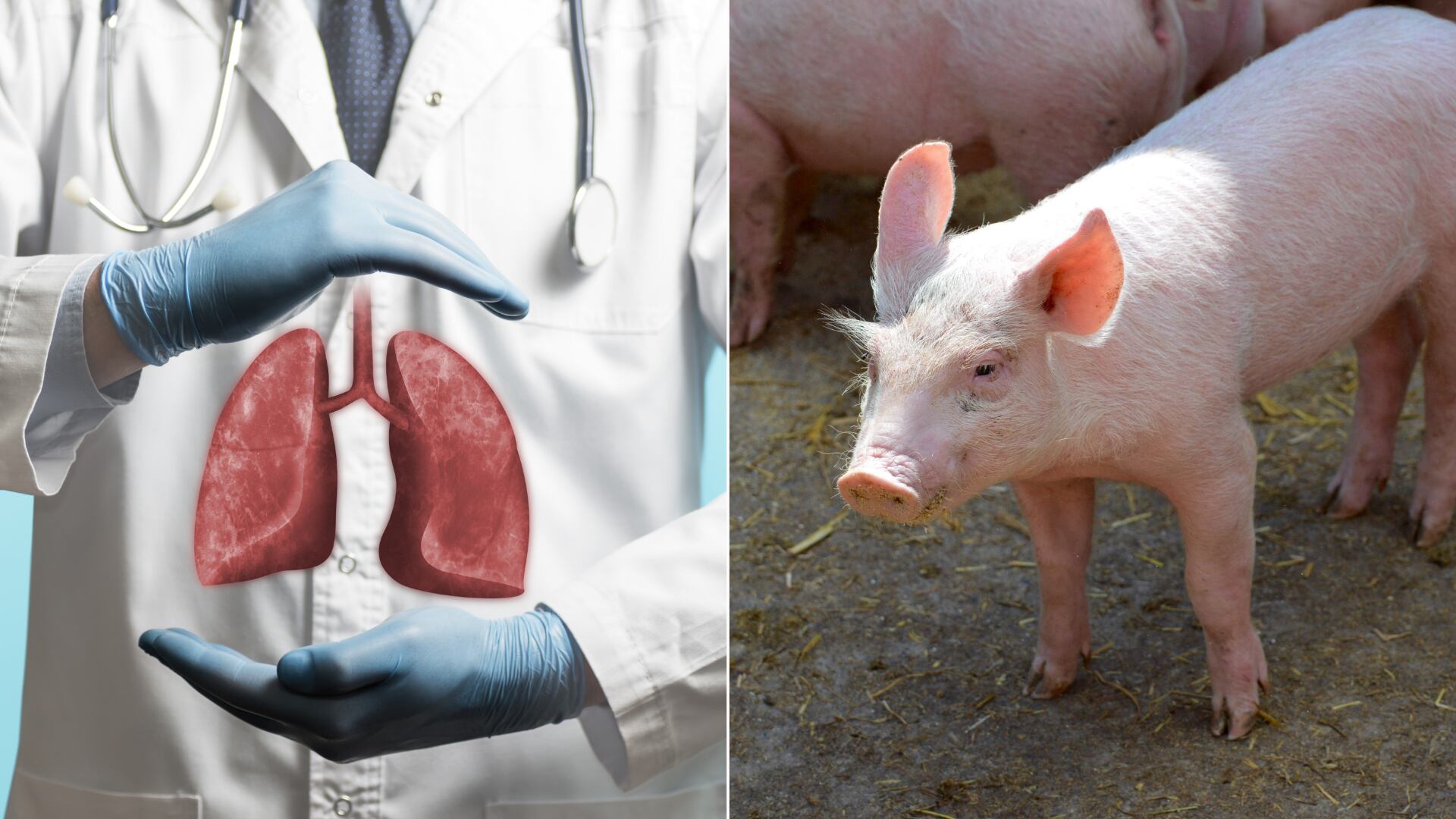 Un pulmón de cerdo permaneció funcional durante nueve días en un humano. El experimento, inédito, marca un hito para los trasplantes entre especies.