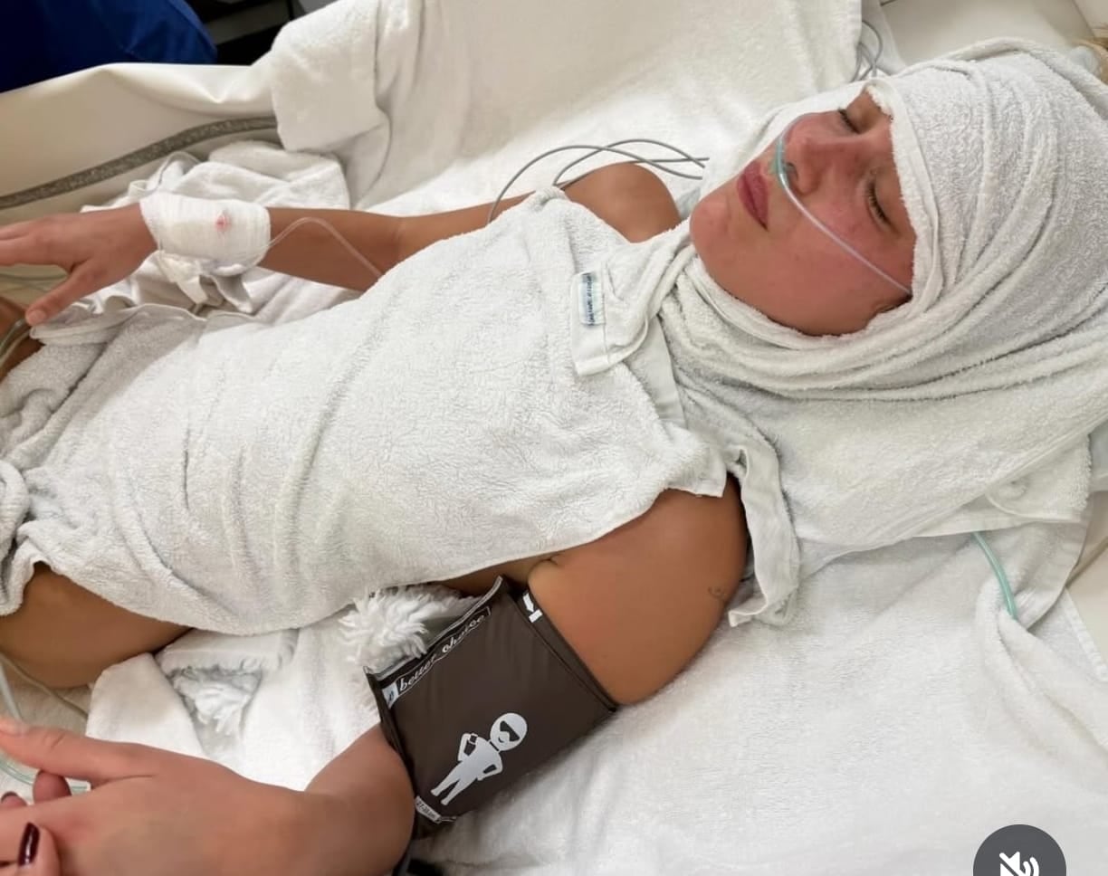 Bella Hadid Enfermedad de Lyme