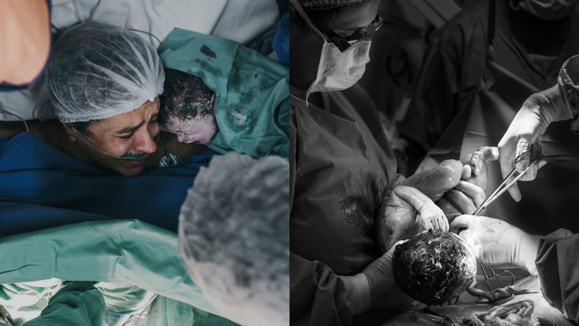 Costa Rica registró una tasa de cesáreas del 33% en 2025. El Ministerio de Salud publica los riesgos quirúrgicos y promueve el parto vaginal en su último informe.