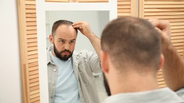 ¿El fin de la calvicie? Raíz ancestral de la medicina china abre una nueva vía para recuperar el cabello