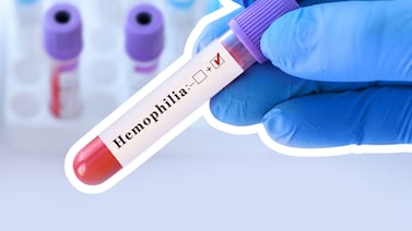 Daniela Latino, microbióloga: ‘Los sangrados prolongados son uno de los principales signos de alerta de la hemofilia’