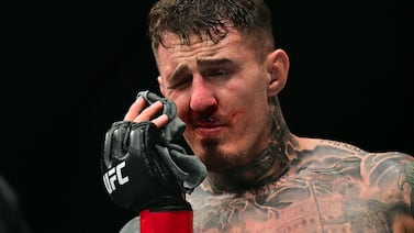Estrella de la UFC sufre rara enfermedad ocular tras recibir un golpe en el ojo durante pelea