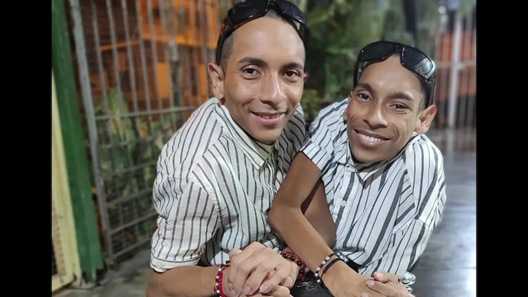 ‘Nacimos juntos, moriremos juntos’: fallecieron los famosos siameses de Ecuador a los 27 años