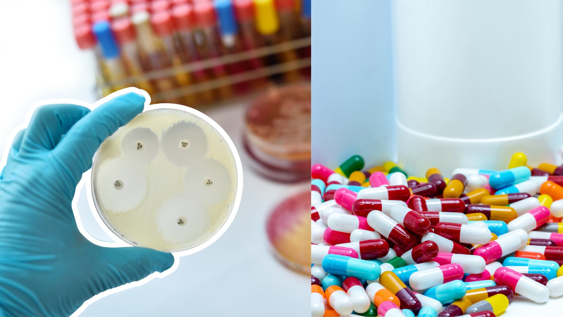 El uso inadecuado de antibióticos acelera la aparición de bacterias resistentes y complica los tratamientos.