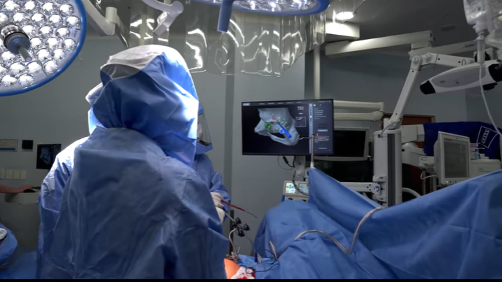 Argentina aplica cirugía robótica en cadera y rodilla. El sistema mejora precisión, reduce daño tisular y acelera la recuperación funcional.