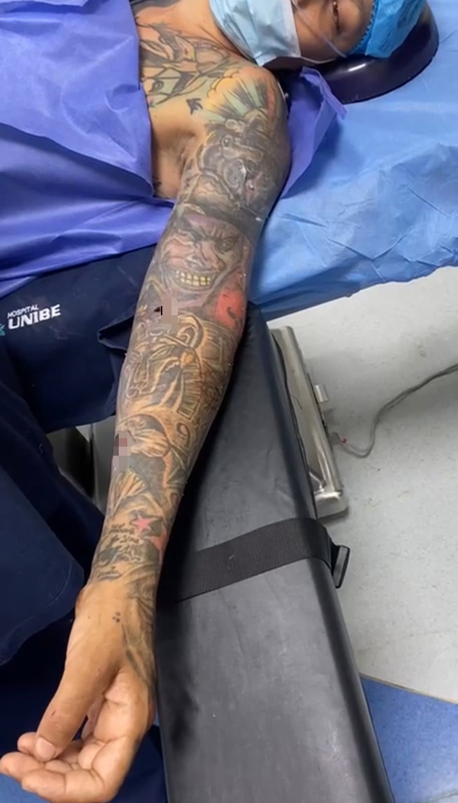 En el expediente del Caso Riverside están documentados varios vídeos en donde se aprecia la operación a la que se sometió Herald José Ruiz Vargas, alias Guato, tras provocarse él mismo una herida con arma de fuego.