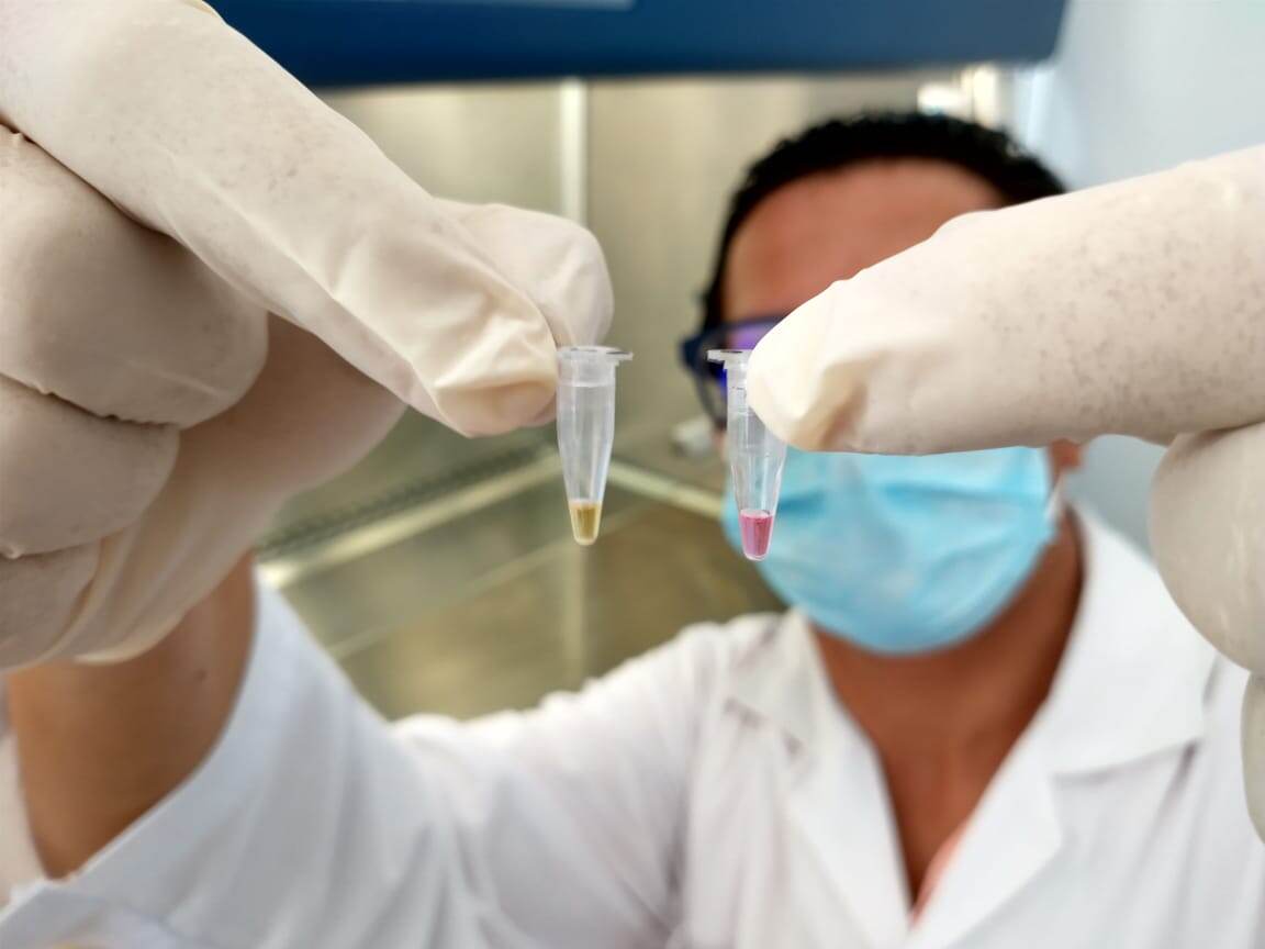Esta es la primera prueba que se realizó con este test experimental, para ello se utilizó ARN sintético del virus.
El color amarillo indica que la prueba es positiva, el rojo, que es negativa.
Fotografía: Andrés Gatica para LN