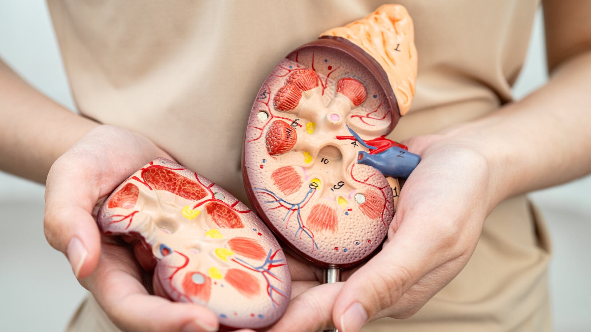 La formación de piedras en los riñones varía según la persona. Una buena hidratación puede prevenir este problema.