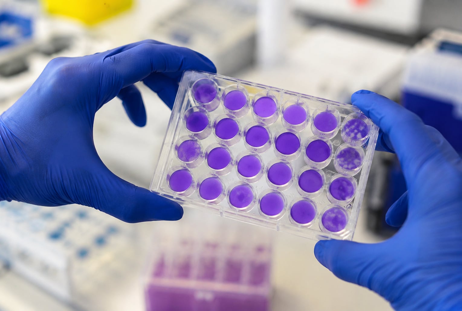 Investigadores argentinos encontraron una región clave compartida por varios virus y avanzan hacia posibles antivirales de amplio espectro.