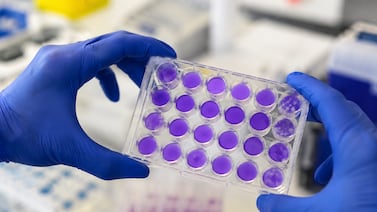 Científicos argentinos hallaron un mecanismo común entre el dengue y otros virus que podría servir para frenar enfermedades actuales y futuras